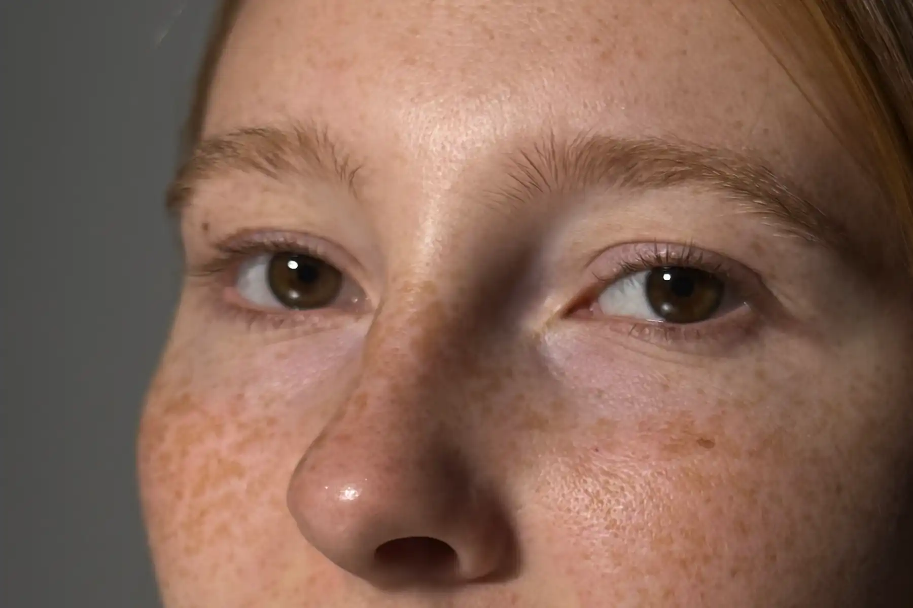 Úprava obočí — před